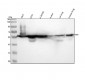 Anti-Vimentin Rabbit Monoclonal Antibody